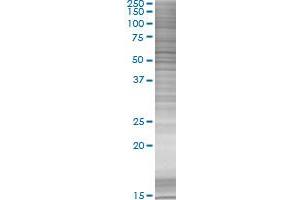 IFIT1 transfected lysate. (IFIT1 293T Cell Transient Overexpression Lysate(Denatured))