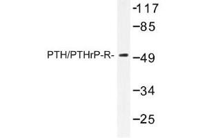 Image no. 1 for anti-Parathyroid Hormone 1 Receptor (PTH1R) antibody (ABIN317698) (PTH1R 抗体)