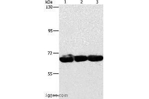 Western blot analysis of 293T, hepG2 and A549 cell, using CKAP4 Polyclonal Antibody at dilution of 1:750 (CKAP4 抗体)