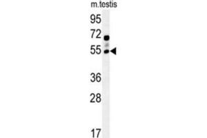 Western Blotting (WB) image for anti-gamma-aminobutyric Acid (GABA) A Receptor, gamma 2 (GABRG2) antibody (ABIN2995557) (GABRG2 抗体)