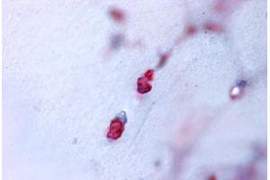 Human Bone, Cartilage (formalin-fixed, paraffin-embedded) stained with ACAN antibody ABIN625841 at 7 ug/ml followed by biotinylated goat anti-rabbit IgG secondary antibody ABIN481713, alkaline phosphatase-streptavidin and chromogen. (Aggrecan 抗体  (N-Term))