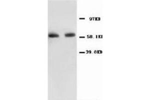 Western blot with NFκBP65 Polyclonal Antibody (NF-kB p65 抗体  (N-Term))