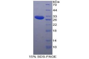 SDS-PAGE analysis of Human SSFA2 Protein. (SSFA2 蛋白)