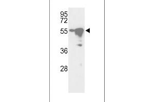 Western blot analysis of hYSK- (ABIN392471 and ABIN2842055) in Ramos and HepG2 cell line lysates (35 μg/lane). (YSK (AA 325-356), (C-Term) 抗体)