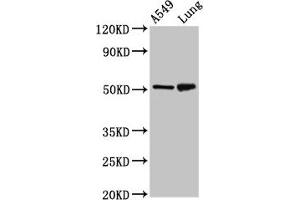 Western Blot Positive WB detected in: A549 whole cell lysate, Rat lung tissue All lanes: IRX3 antibody at 5 μg/mL Secondary Goat polyclonal to rabbit IgG at 1/50000 dilution Predicted band size: 53 kDa Observed band size: 53 kDa (IRX3 抗体  (AA 285-378))
