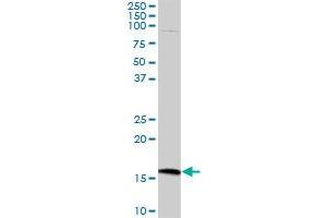 CMTM5 MaxPab polyclonal antibody. (CMTM5 抗体  (AA 1-156))