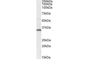 Image no. 1 for anti-Membrane-Spanning 4-Domains, Subfamily A, Member 1 (MS4A1) (C-Term) antibody (ABIN401667) (CD20 抗体  (C-Term))