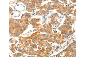 Immunohistochemistry (IHC) image for anti-ADAM Metallopeptidase with thrombospondin Type 1 Motif, 18 (ADAMTS18) antibody (ABIN2429045) (ADAMTS18 抗体)