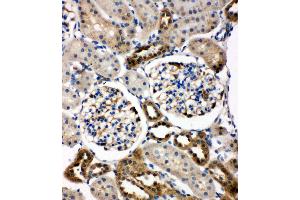 Anti-WISP1 antibody, IHC(P) IHC(P): Rat Kidney Tissue (WISP1 抗体  (C-Term))