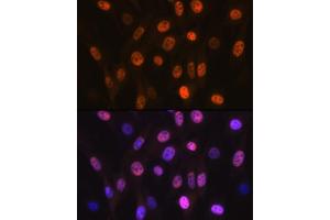Immunofluorescence analysis of NIH-3T3 cells using B Rabbit mAb (ABIN7265377) at dilution of 1:100 (40x lens). (ANP32B 抗体)
