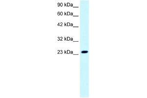 FLJ11730 antibody used at 0. (FLJ11730 (N-Term) 抗体)