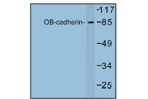 Image no. 1 for anti-Cadherin 11 (CDH11) antibody (ABIN317681) (OB Cadherin 抗体)