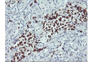 Immunohistochemistry (IHC) image for anti-Tumor Protein P53 (TP53) antibody (ABIN1499978) (p53 抗体)