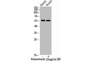 Western Blot analysis of HepG2 cells using Phospho-XIAP (S87) Polyclonal Antibody (XIAP 抗体  (pSer87))