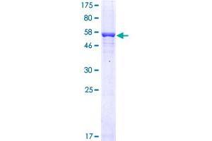 Image no. 1 for Ficolin (Collagen/fibrinogen Domain Containing) 1 (FCN1) (AA 1-326) protein (GST tag) (ABIN1353908) (FCN1 Protein (AA 1-326) (GST tag))