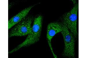 NIH/3T3 cells were stained with Hsp27(S78) (5E1 ) Monoclonal Antibody  at [1:200] incubated overnight at 4C, followed by secondary antibody incubation, DAPI staining of the nuclei and detection. (HSP27 抗体  (pSer78))