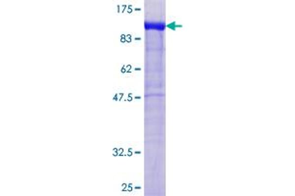 WASF2 Protein (AA 1-498) (GST tag)