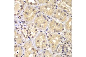 Immunohistochemistry of paraffin-embedded human kidney using KPNA6 antibody at dilution of 1:100 (x400 lens). (KPNA6 抗体)