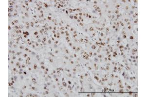 Immunostaining (ISt) image for anti-Topoisomerase (DNA) I (TOP1) (AA 692-765) antibody (ABIN563222)