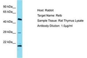 Image no. 1 for anti-V-Rel Reticuloendotheliosis Viral Oncogene Homolog B (RELB) (AA 380-429) antibody (ABIN6750252) (RELB 抗体  (AA 380-429))