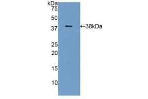 Western blot analysis of recombinant Human GAL8. (LGALS8 抗体  (AA 1-317))