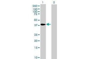 Lane 1: ZNF524 transfected lysate ( 28. (ZNF524 293T Cell Transient Overexpression Lysate(Denatured))