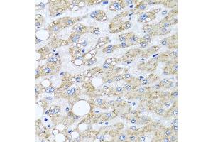 Immunohistochemistry of paraffin-embedded human liver damage using SRI antibody  at dilution of 1:100 (40x lens). (SRI 抗体  (AA 1-198))