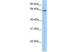 KIAA1958 antibody used at 1 ug/ml to detect target protein. (KIAA1958 抗体  (C-Term))