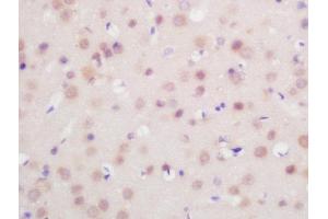 Formalin-fixed and paraffin embedded mouse brain labeled with Rabbit Anti-FoxP1 Polyclonal Antibody, Unconjugated  at 1:200 followed by conjugation to the secondary antibody and DAB staining (FOXP1 抗体  (AA 581-705))
