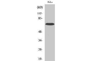 Western Blotting (WB) image for anti-Interleukin 17 Receptor C (IL17RC) (C-Term) antibody (ABIN3175627) (IL17RC 抗体  (C-Term))