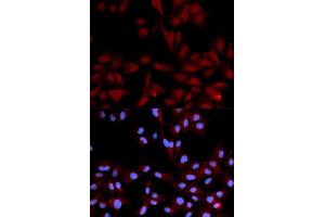 Immunofluorescence (IF) image for anti-Mitogen-Activated Protein Kinase 14 (MAPK14) (pTyr182) antibody (ABIN1870378) (MAPK14 抗体  (pTyr182))