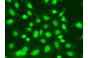 Immunofluorescence analysis of A549 cells using LIG1 antibody. (LIG1 抗体)