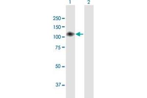 Western Blot analysis of ENPP2 expression in transfected 293T cell line by ENPP2 MaxPab polyclonal antibody. (ENPP2 抗体  (AA 1-863))