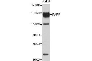 Western blot analysis of extracts of Jurkat cells, using PARP1 antibody (ABIN5995673) at 1/1000 dilution. (PARP1 抗体)
