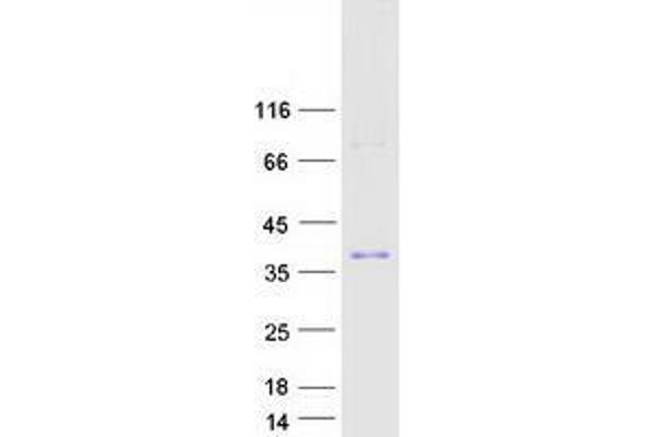 ZFAND5 Protein (Transcript Variant C) (Myc-DYKDDDDK Tag)