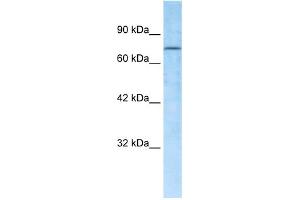 WB Suggested Anti-RBAK Antibody Titration:  0. (RBAK 抗体  (Middle Region))