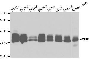 Western blot analysis of extracts of various cell lines, using TPP1 antibody. (TPP1 抗体)