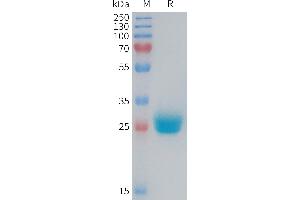 Coxsackie Adenovirus Receptor Protein (AA 20-237) (His tag)