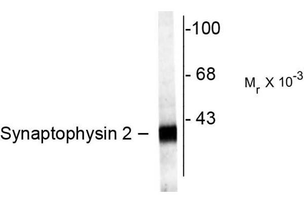 Synaptoporin 抗体  (C-Term)