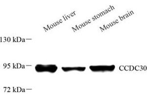 Western blot analysis of CCDC30 (ABIN7073536) at dilution of 1: 500 (CCDC30 抗体)