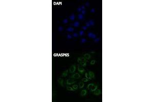 Immunofluorescence (IF) image for Donkey anti-Rabbit IgG antibody (FITC) (ABIN2667148) (驴 anti-兔 IgG Antibody (FITC))