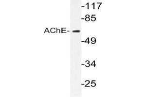 Western blot (WB) analyzes of AChE antibody in extracts from Jurkat cells. (Acetylcholinesterase 抗体)