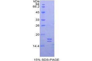 SDS-PAGE analysis of Human Glycocalicin Protein. (Glycocalicin 蛋白)
