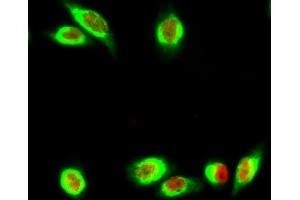 Immunofluorescence analysis of Hela cell. (Ki-67 抗体)