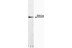 Western blot analysis of ATP Synthase alpha on Jurkat cell lysate. (ATP Synthase alpha (AA 113-220) 抗体)