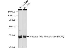 Western blot analysis of extracts of various cell lines, using Prostatic Acid Phosphatase (ACPP) (PAP/ACPP) Rabbit mAb (ABIN1683136, ABIN3018597, ABIN3018598 and ABIN7101633) at 1:1000 dilution. (ACPP 抗体)