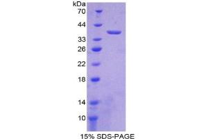 SDS-PAGE analysis of Mouse LDHB Protein. (LDHB 蛋白)