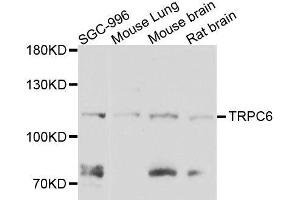 Western blot analysis of extracts of various cell lines, using TRPC6 antibody. (TRPC6 抗体  (AA 500-600))