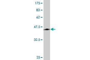 Western Blotting (WB) image for anti-Orosomucoid 1 (ORM1) (AA 18-201) antibody (ABIN562078)