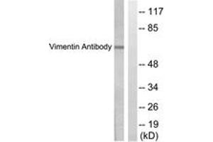 Western Blotting (WB) image for anti-Vimentin (VIM) (AA 411-460) antibody (ABIN2889287) (Vimentin 抗体  (AA 411-460))